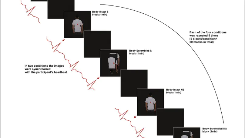 Interoceptive signals impact visual processing. Cardiac modulation of visual body perception