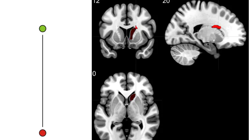 Disownership of body parts as revealed by a visual scale evaluation. An observational study